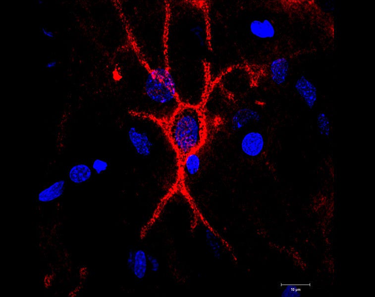 Perineuronal nets surrounding neurons in mouse brain